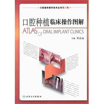 ����ǻ�Nֲ�R�������D��